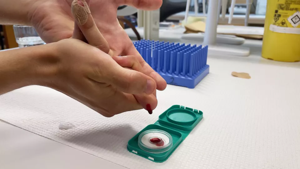 person droppar blodprov från fingret i en lite blodprovsask. foto.